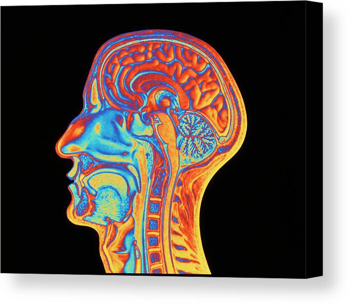 People Person Persons Canvas Print featuring the photograph Coloured Mri Scan Of The Human Head (side View) by Pasieka