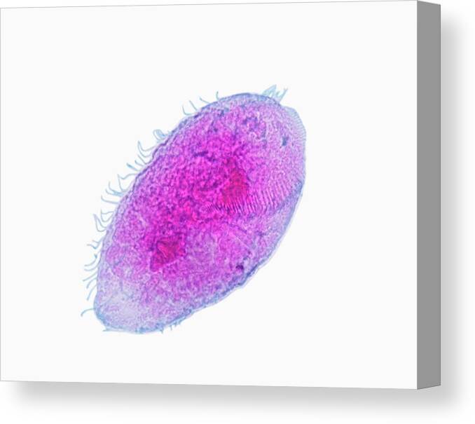 Horizontal Canvas Print featuring the photograph Stentor Ciliate Protozoan Lm X100 by Science Stock Photography/science Photo Library
