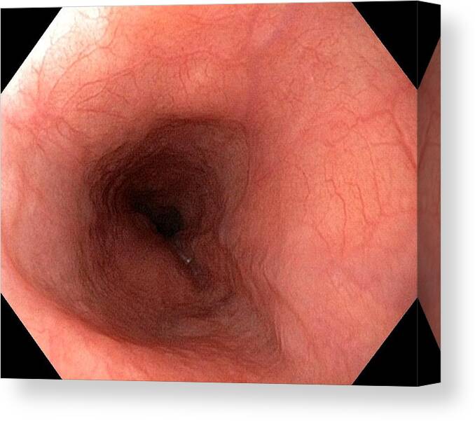 Endoscopic View Canvas Print featuring the photograph Healthy Oesophagus #2 by Gastrolab