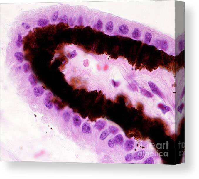 Aqueous Humour Canvas Print featuring the photograph Ciliary Body Epithelium #2 by Jose Calvo / Science Photo Library