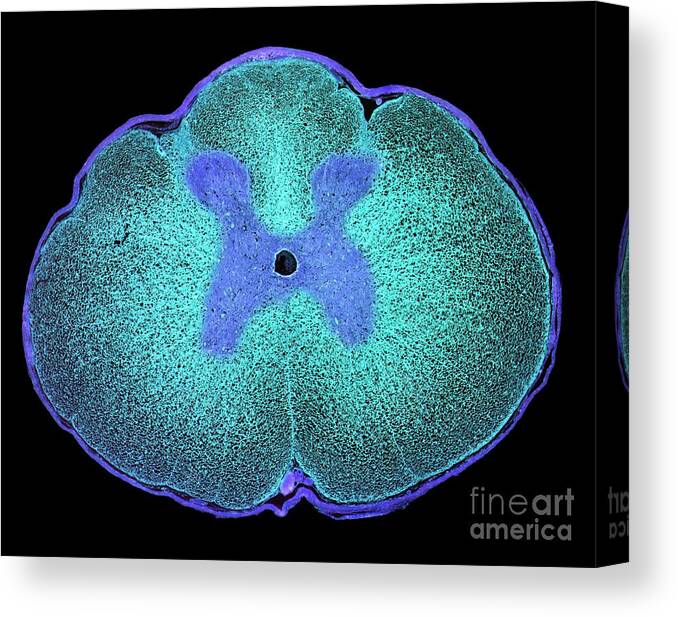 Anatomy Canvas Print featuring the photograph Spinal Cord #3 by Steve Gschmeissner/science Photo Library