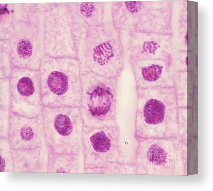Anaphase Canvas Print featuring the photograph Mitosis #5 by Jose Calvo / Science Photo Library