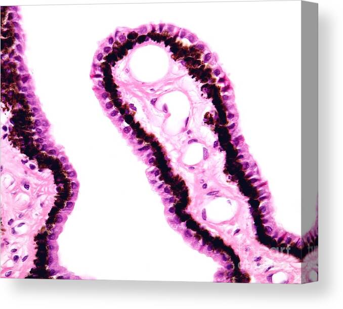 Light Microscope Canvas Print featuring the photograph Ciliary Body Epithelium by Jose Calvo / Science Photo Library