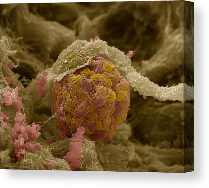 Brown Canvas Print featuring the photograph Glomerulus In Kidney by Meckes/ottawa