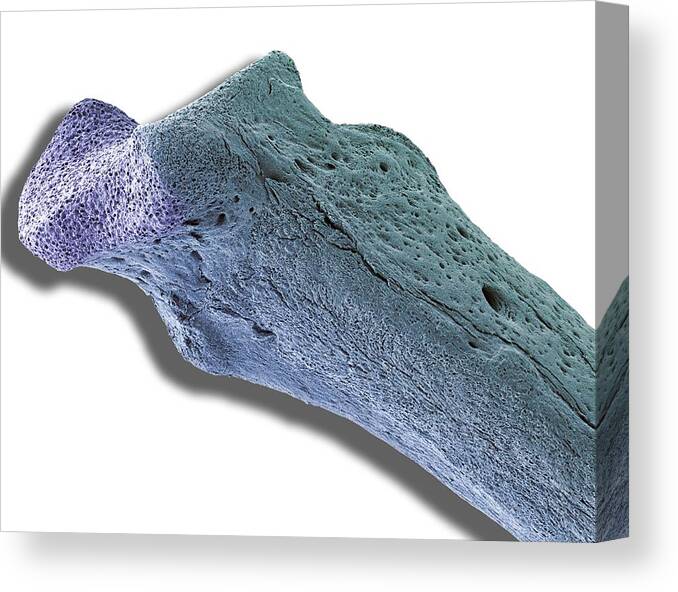 White Background Canvas Print featuring the photograph Scanning electron micrograph (SEM) of human bone, osteoporosis by Steve Gschmeissner/spl