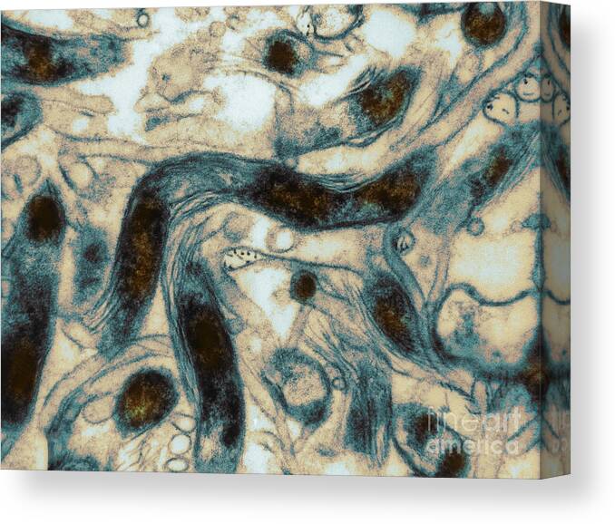 Science Canvas Print featuring the photograph Borrelia Burgdorferi Lyme Disease Tem #3 by David M Phillips