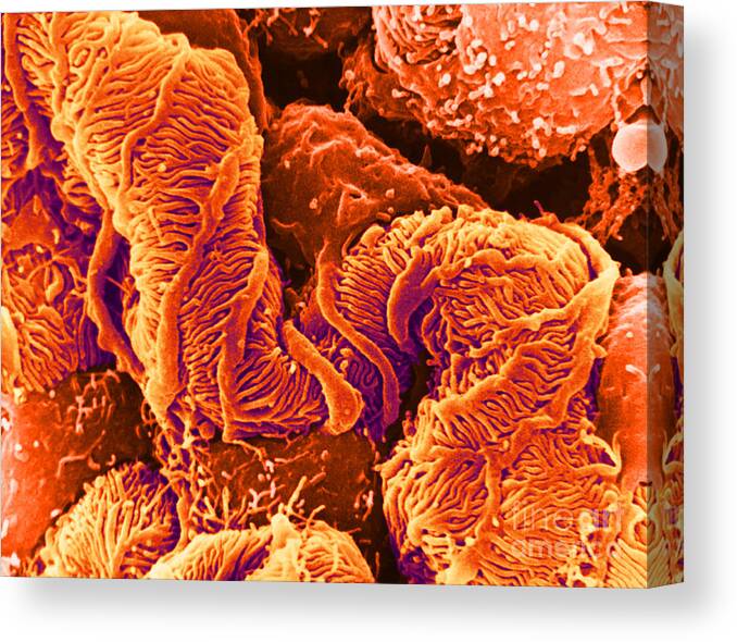 Science Canvas Print featuring the photograph Glomerulus, Sem #2 by David M. Phillips