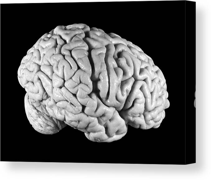 Brain Canvas Print featuring the photograph Einstein's Brain #4 by Otis Historical Archives, National Museum Of Health And Medicine
