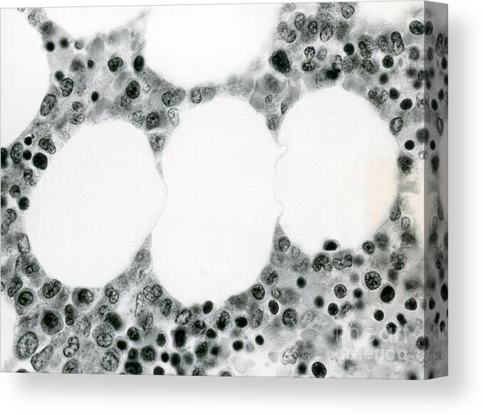 Histological Canvas Print featuring the photograph Bone Marrow & Fat Cells, Lm by David M. Phillips