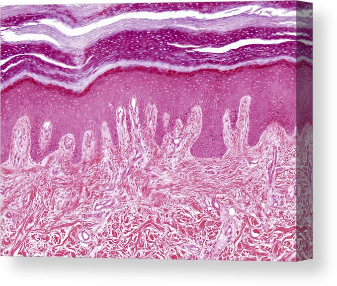 Skin Canvas Print featuring the photograph Plantar Skin, Lm by Alvin Telser