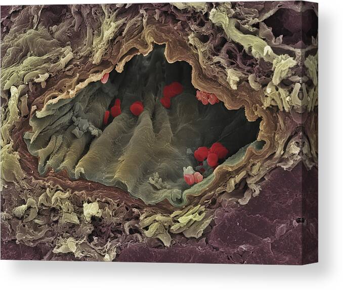 Artery Canvas Print featuring the photograph Artery Sem #1 by Steve Gschmeissner