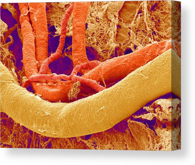 Artery Canvas Print featuring the photograph Brain Blood Vessels, Sem #1 by Susumu Nishinaga