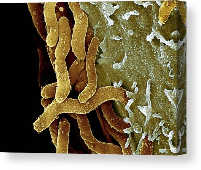 Helicobacter Pylori Canvas Print featuring the photograph Helicobacter Pylori Bacteria, Sem #9 by 