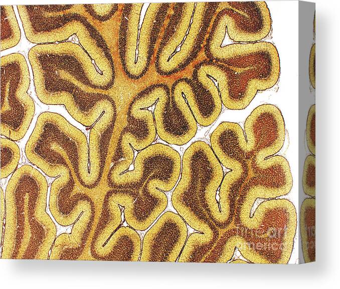 Brain Canvas Print featuring the photograph Cerebellum #2 by Microscape/science Photo Library