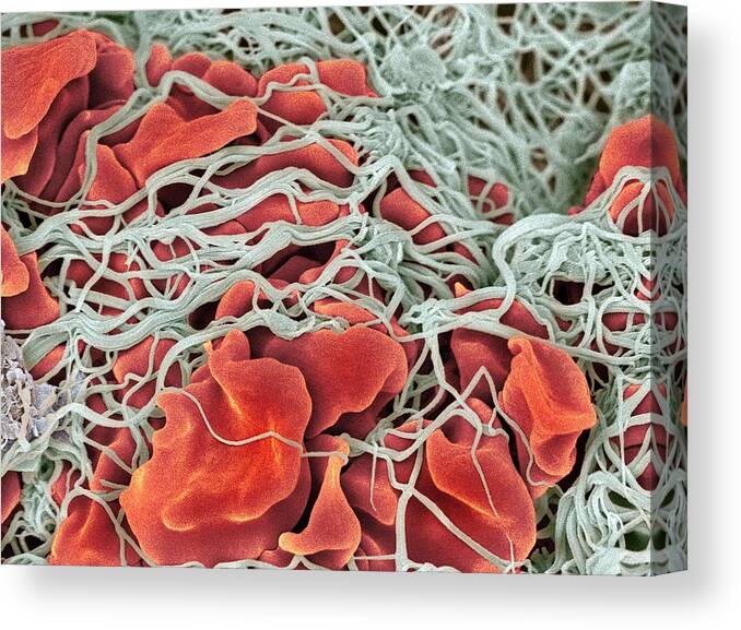 Physiology Canvas Print featuring the photograph Scanning electron microscope (SEM) of red blood cell #1 by Science Photo Library - STEVE GSCHMEISSNER.
