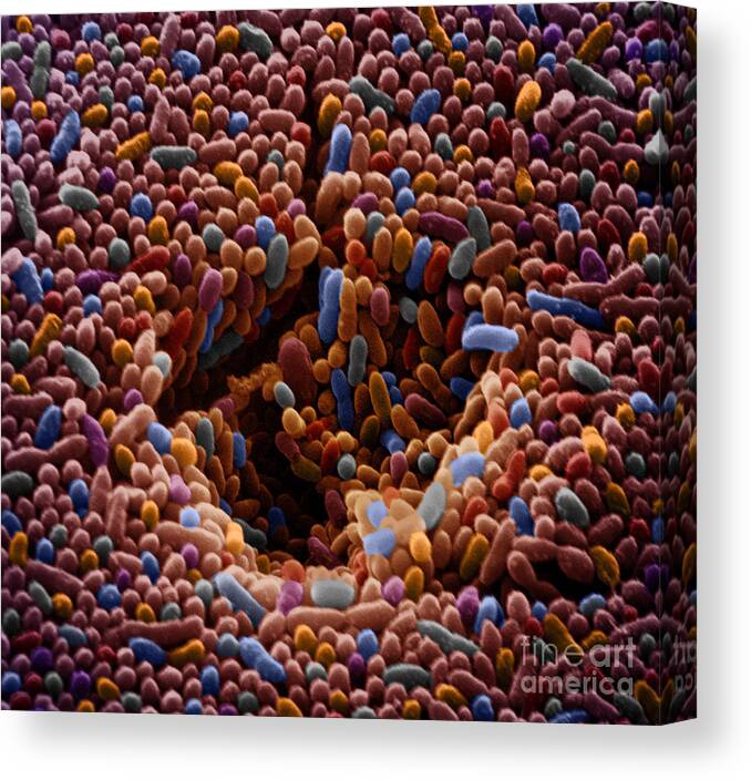 Sem Canvas Print featuring the photograph Sem Of Polluted Water #16 by David M. Phillips