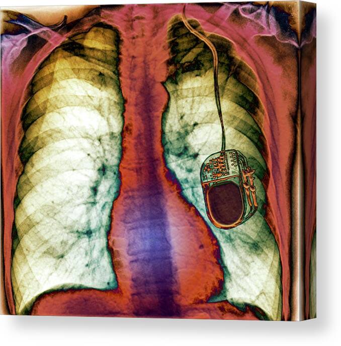 Nobody Canvas Print featuring the photograph Parkinson's Brain Pacemaker #4 by Zephyr
