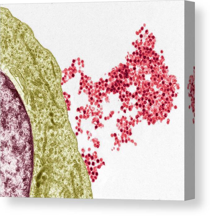 Burkett'ss Lymphoma Canvas Print featuring the photograph Epstein-barr Virus by Steve Gschmeissner