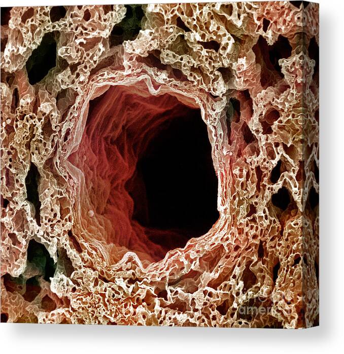 Sem Canvas Print featuring the photograph Sem Of Lung #1 by Science Source