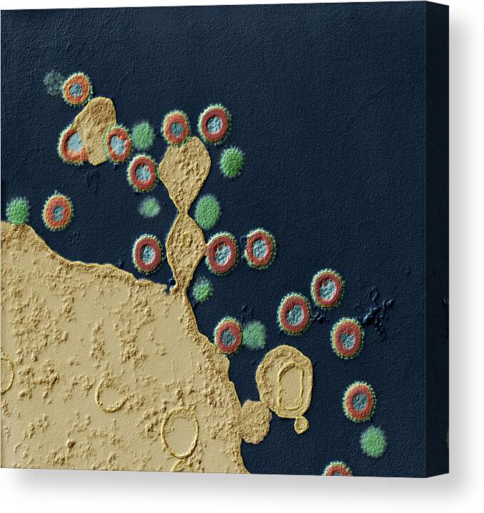 Acquired Immune Deficiency Canvas Print featuring the photograph Effect Of Protease Inhibitors On Hiv Tem by Meckes/ottawa