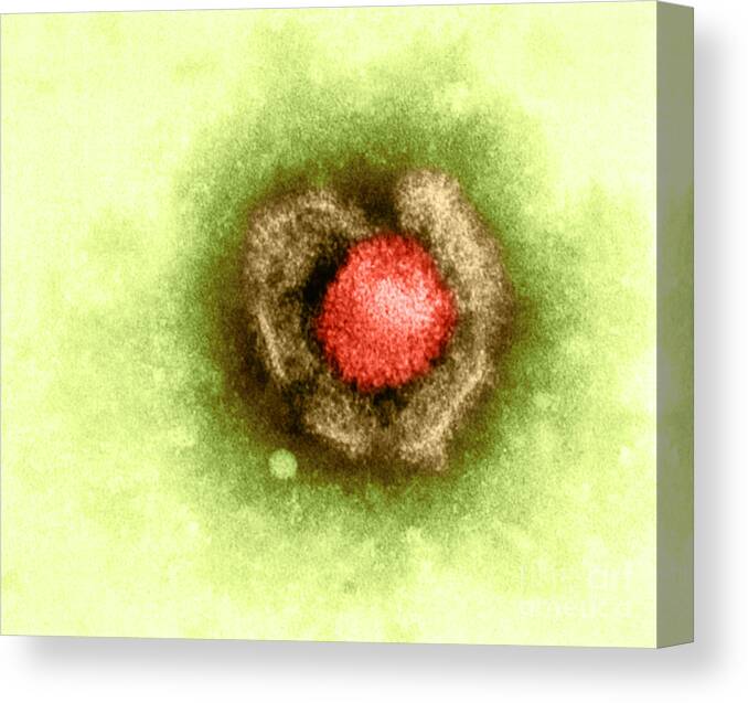 Barr Canvas Print featuring the photograph Herpes Simplex Virus #3 by Kwangshin Kim