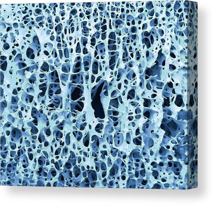 Anatomical Canvas Print featuring the photograph Bone Tissue #5 by Steve Gschmeissner