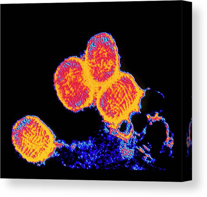 Orthopoxvirus Variola Canvas Print featuring the photograph Coloured Tem Of Smallpox Variola Viruses by Alfred Pasieka/science Photo Library