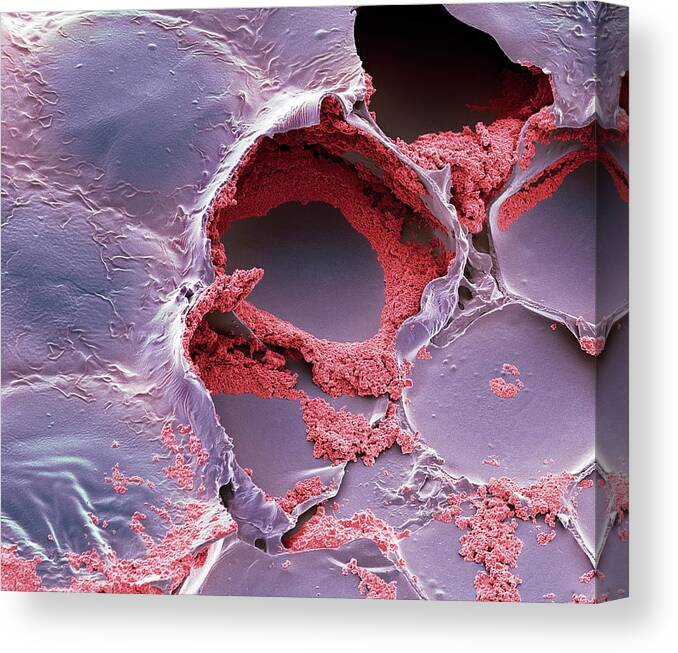 Scanning Electron Micrograph Canvas Print featuring the photograph Electronic Ink by Steve Gschmeissner