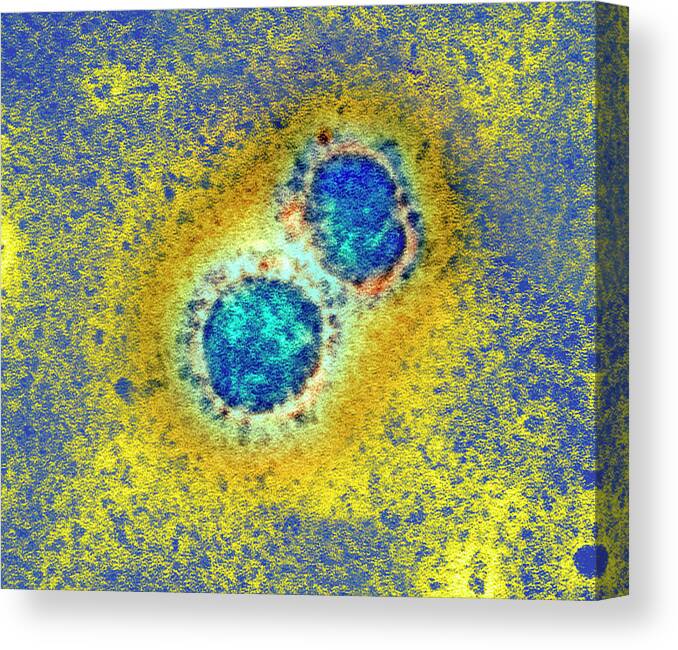 Coronavirus Canvas Print featuring the photograph Sars Virus Particles by A. Dowsett, Public Health England/science Photo Library