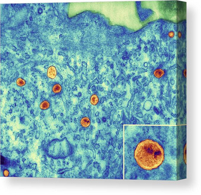 Hiv Canvas Print featuring the photograph Hiv Particles In Infected Cell, Tem by Thomas Deerinck, Ncmir