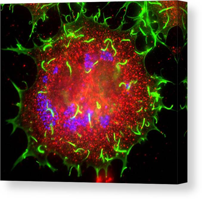 Actin Canvas Print featuring the photograph Vaccinia Virus Infected Cell #12 by Dr Dan Kalman