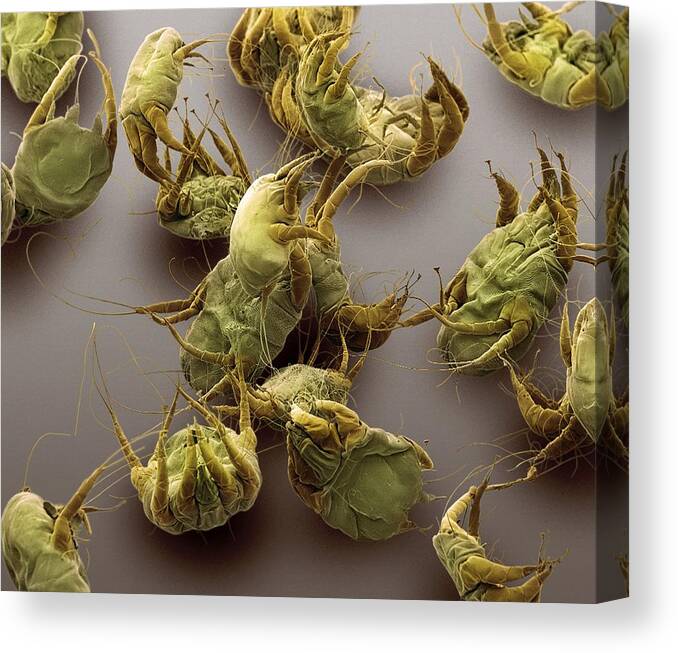 Animal Canvas Print featuring the photograph Sarcoptic Mange Mites, Sem #2 by Steve Gschmeissner
