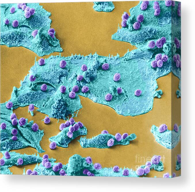 Science Canvas Print featuring the photograph Immune Cells Attacking Cancer Cells, Sem #4 by Science Source