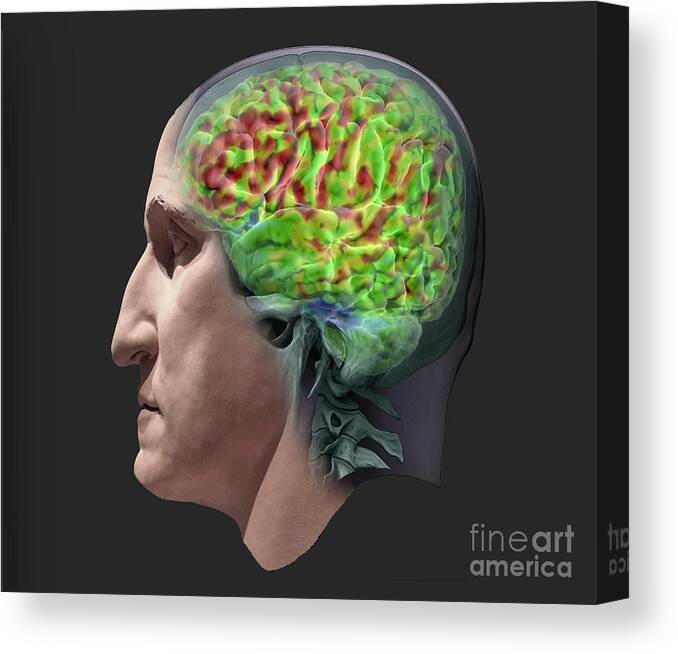 Organ Canvas Print featuring the photograph Human Brain's Left Hemisphere #2 by Zephyr/science Photo Library