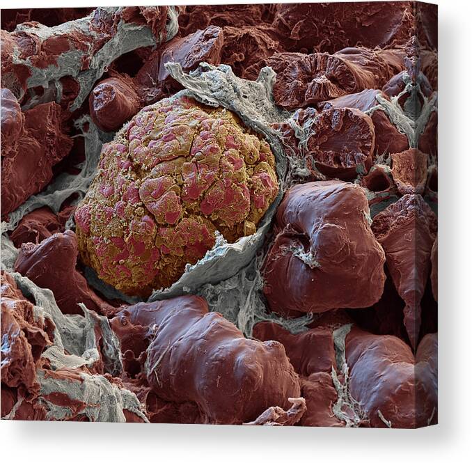 Excretory System Canvas Print featuring the photograph Kidney Glomerulus, Sem #3 by Oliver Meckes EYE OF SCIENCE