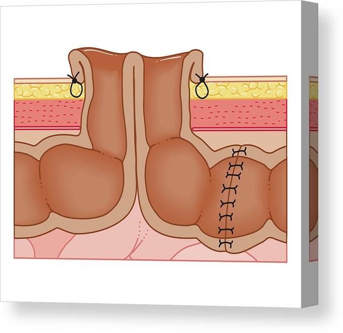 White Background Canvas Print featuring the digital art Cross Section Biomedical Illustration #4 by Dorling Kindersley