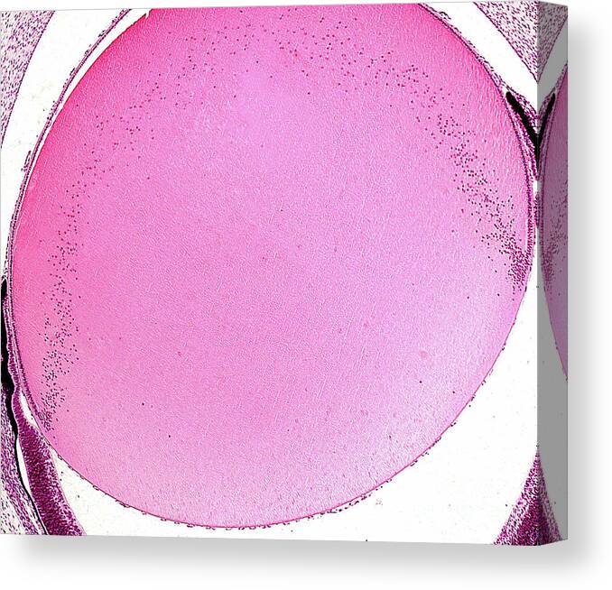 Lens Canvas Print featuring the photograph Eye Lens Fibres by Jose Calvo / Science Photo Library