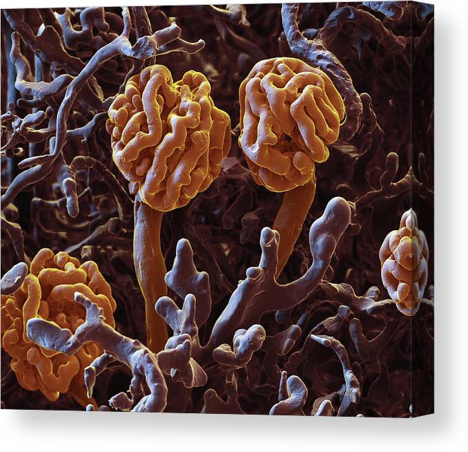 Capillary Canvas Print featuring the photograph Glomeruli, Sem by Oliver Meckes EYE OF SCIENCE
