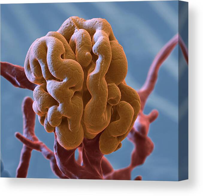 Capillary Canvas Print featuring the photograph Glomerulus, Sem by Oliver Meckes EYE OF SCIENCE