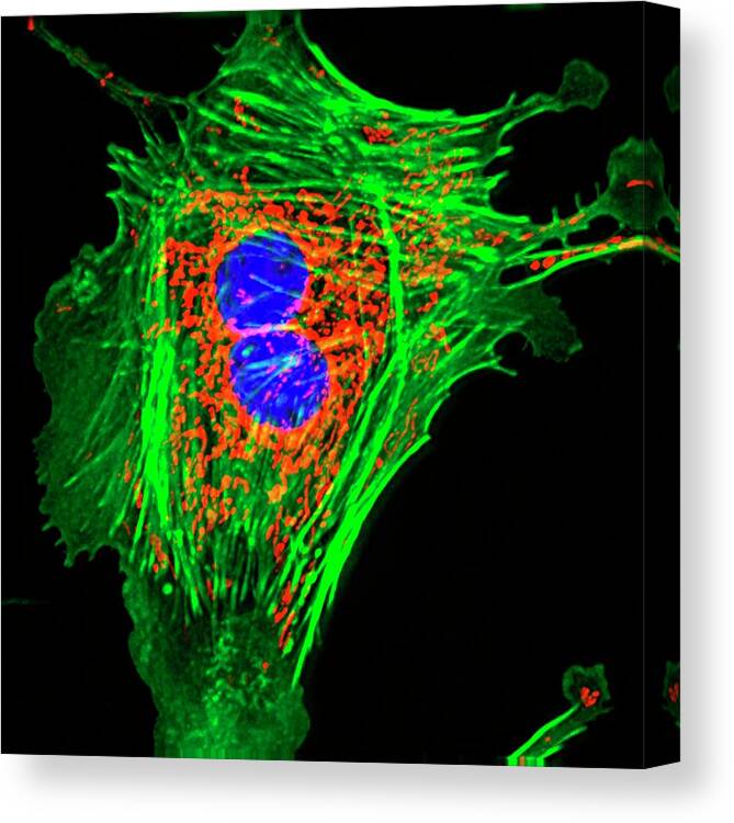 Cell Canvas Print featuring the photograph Pulmonary Artery Cells #2 by R. Bick, B. Poindexter, Ut Medical School/science Photo Library