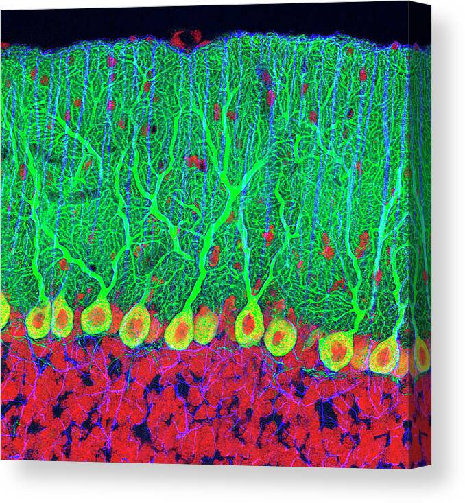 Purkinje Cell Canvas Print featuring the photograph Purkinje Nerve Cells In The Cerebellum by Thomas Deerinck, Ncmir