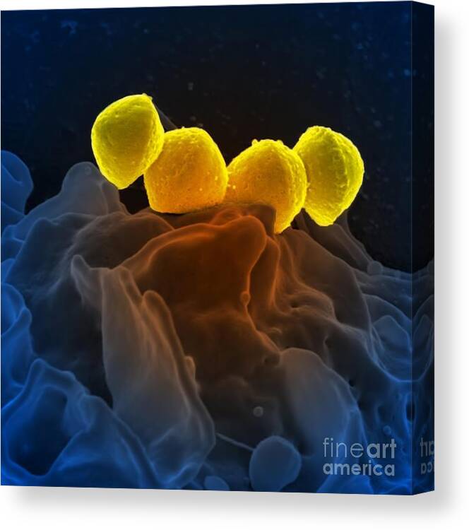 Microbiology Canvas Print featuring the photograph Streptococcus Pyogenes Bacteria Sem by Science Source