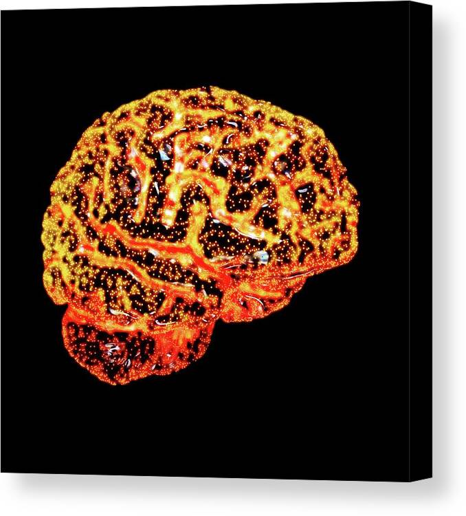 Brain Canvas Print featuring the photograph Human Brain #6 by Russell Kightley