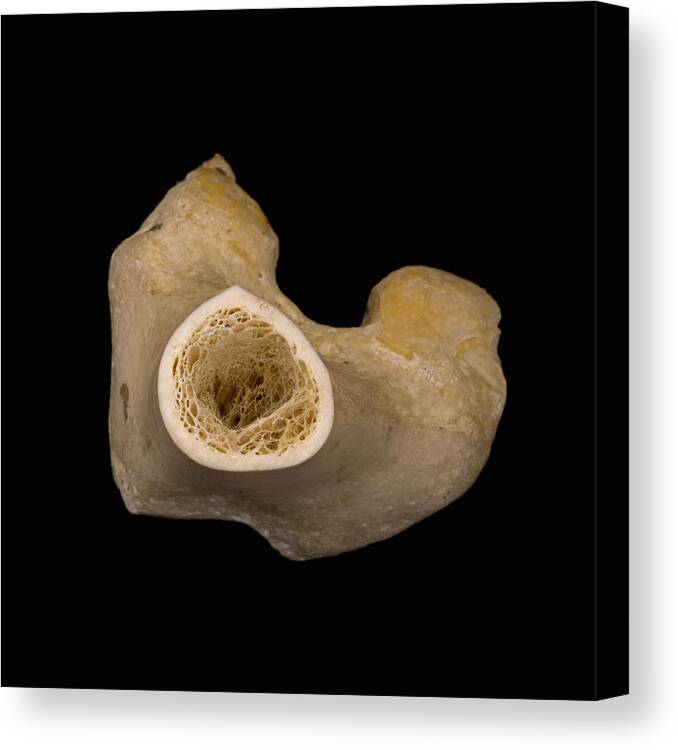 Bone Cross Section Lm Canvas Print Canvas Art By Science Stock Photography