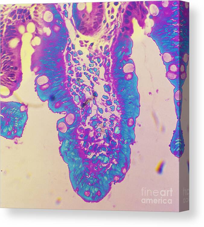 Histology Canvas Print featuring the photograph Cryptosporidium In Intestine Of Baby by Dr. Cecil H. Fox