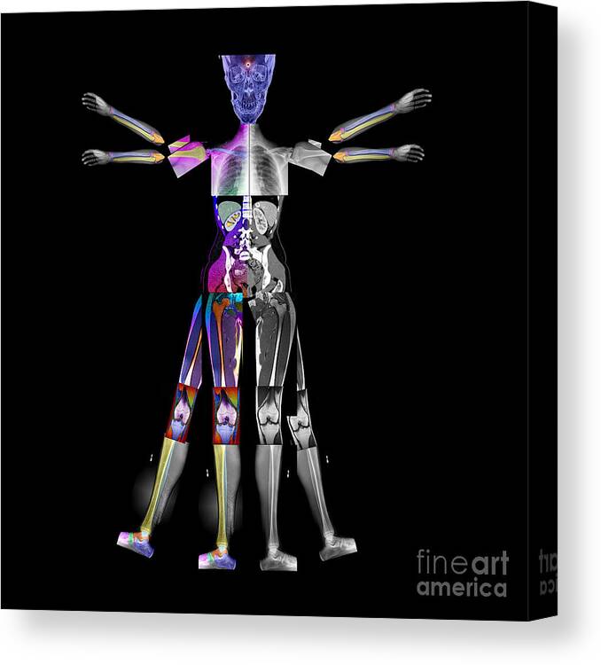 Ct Of Body Canvas Print featuring the photograph Enhanced Composite Imaging Of Modern Man by Living Art Enterprises