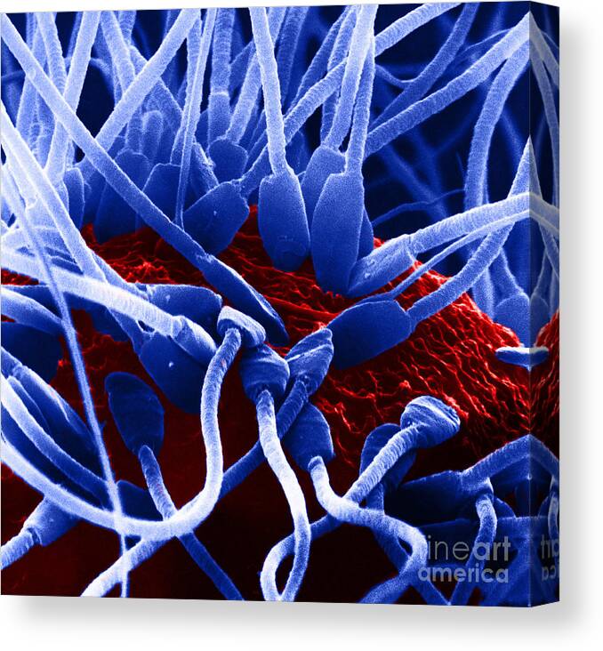 Medical Canvas Print featuring the photograph Fertilization In Rat Sem by David M. Phillips