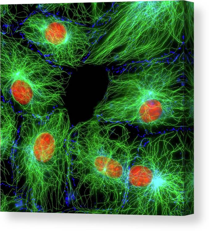 Cytoskeleton Canvas Print featuring the photograph Fibroblast Cells by Dr Jan Schmoranzer/science Photo Library