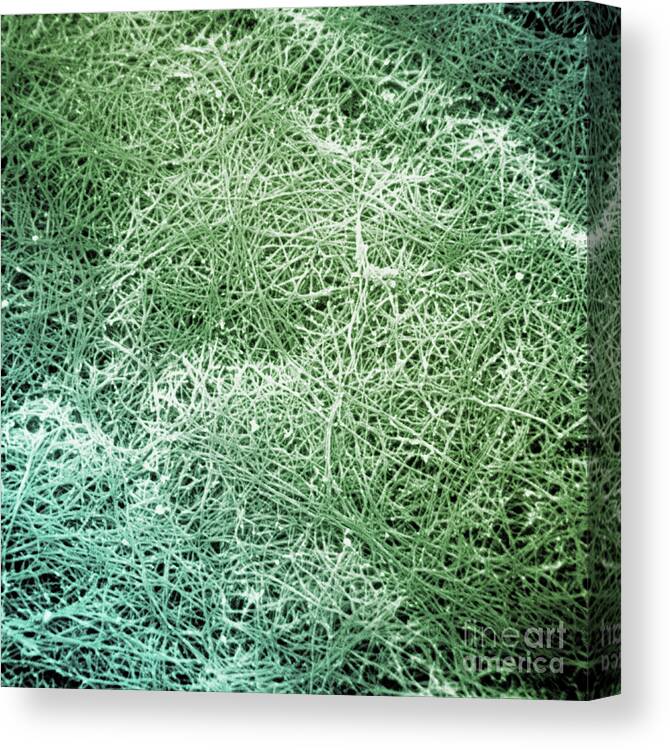 Sem Canvas Print featuring the photograph Sem Of Collagen by David M. Phillips