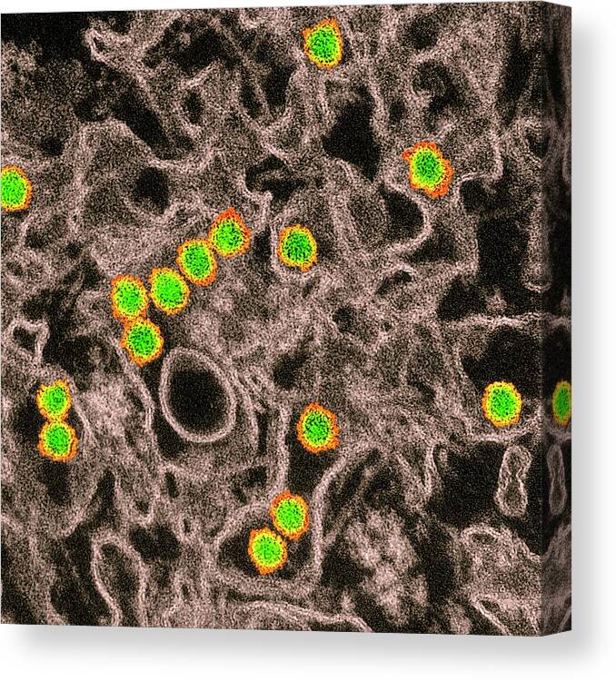 Zika Canvas Print featuring the photograph Zika Virus by Cdc